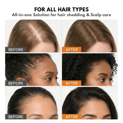 Livioram® Growturn Scalp Serum