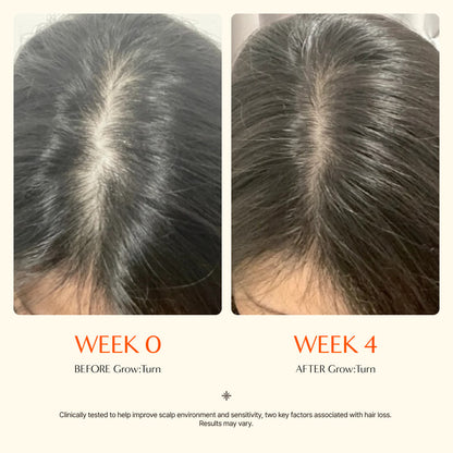 Livioram® Growturn Scalp Serum