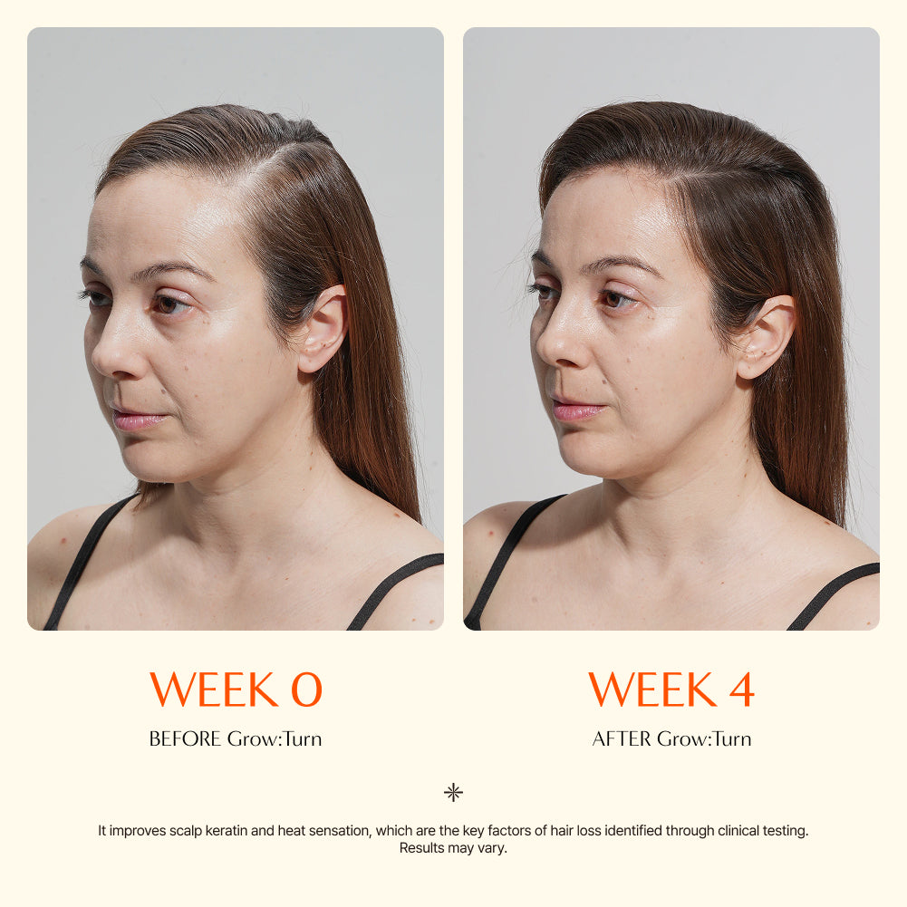 Livioram® Growturn Scalp Serum