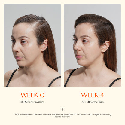 Livioram® Growturn Scalp Serum